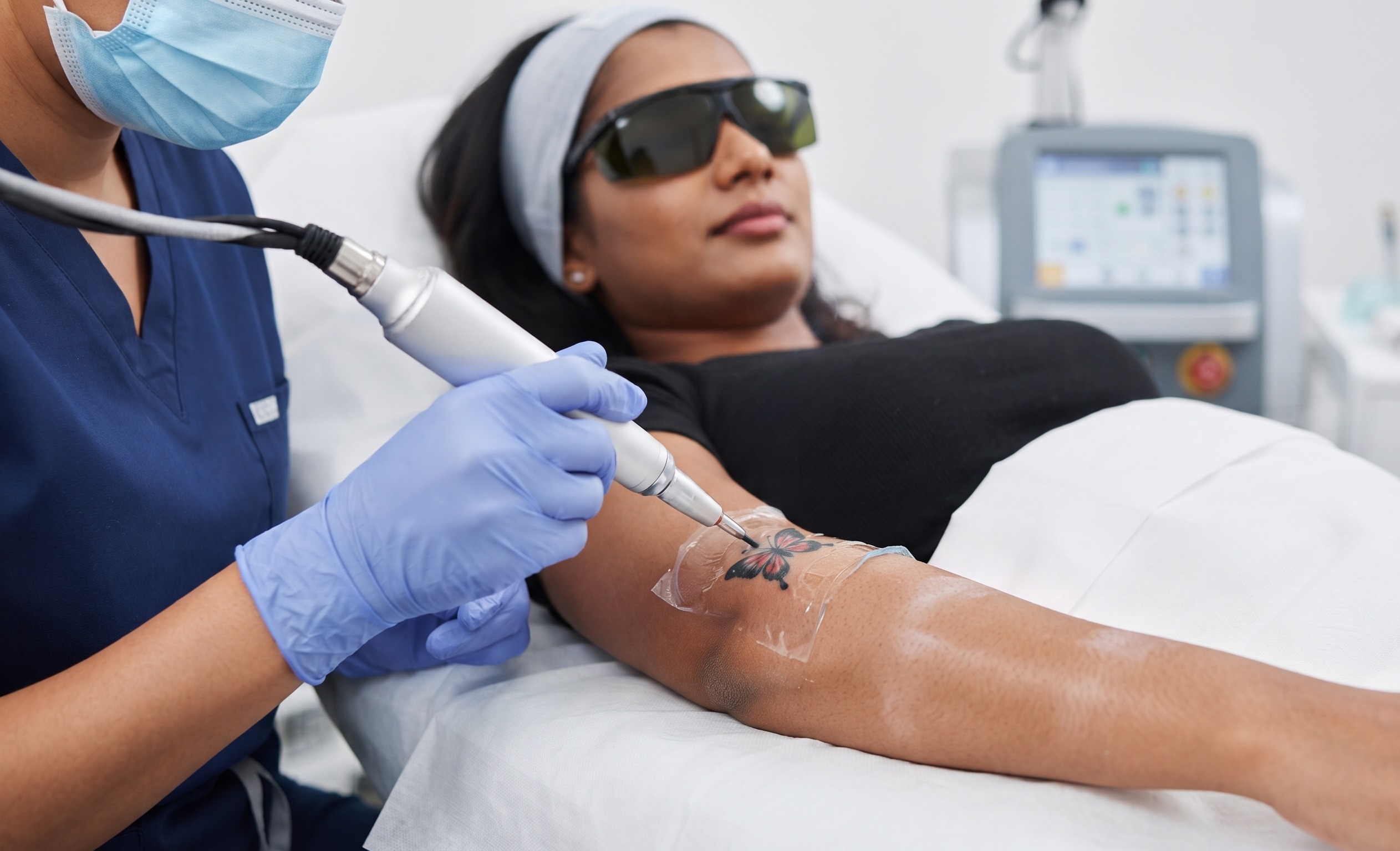 Tattoo Removal Laser